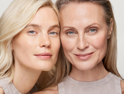 merz aesthetics image felicity tanja two women