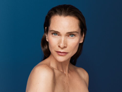 Merz Aesthetics Radiesse vrouw Image