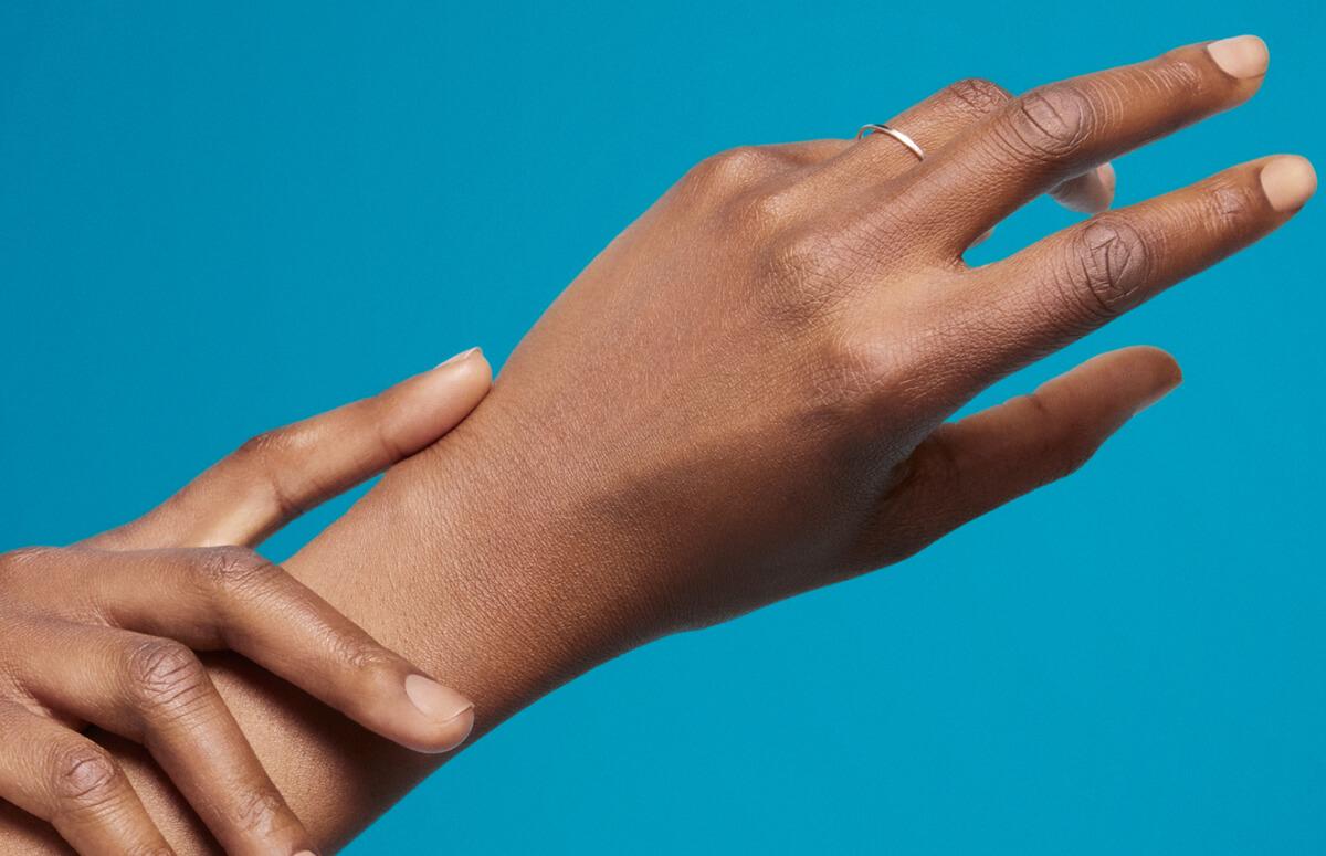 radiesse refresh behandeling handverjonging
