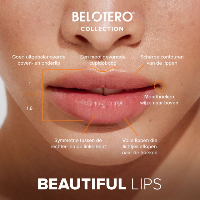 Belotero lipfillers behandelzones
