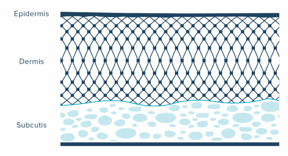 Diagram van de epidermis, dermis en subcutis.