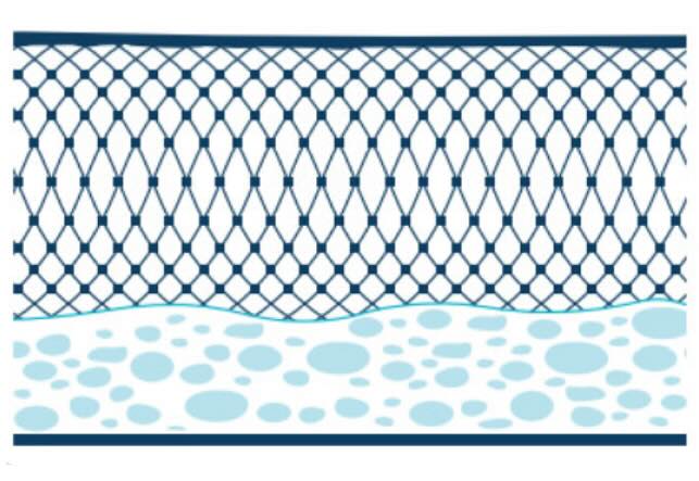 Diagram van de huid.
