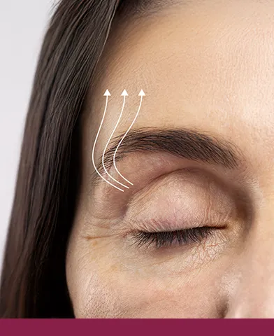 Detail van het oog en de wenkbrauw van een vrouw met rijpe huid. Pijltjes geven aan hoe de wenkbrauw gelift kan worden.