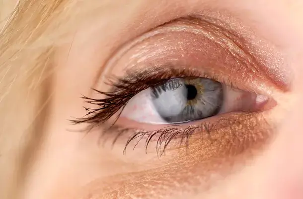 Close-up van een oog met zichtbaar diepe traangoot en donkere schaduw onder het oog.