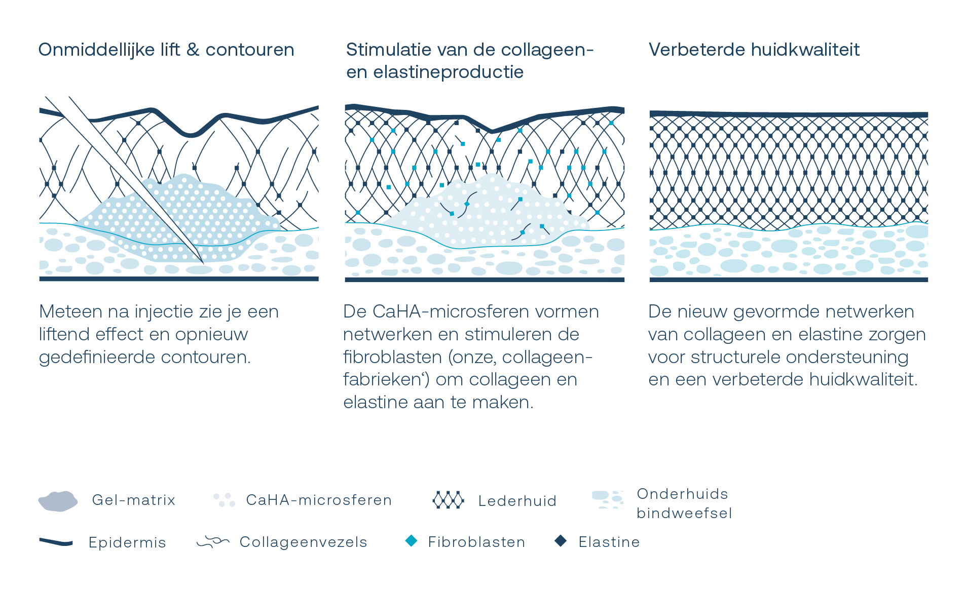 hoe werkt een radiesse huidbehandeling